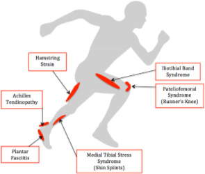 Common Running Injuries