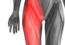 Hip Flexor Pain