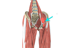 Hip Flexor Strain